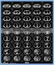 Konida Medical X-ray Film Blue Film Dry Image Thermal Fuji Dry Film thumbnail-2