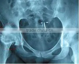 China Raio x Panoramico Odontologico Film KND-A/F CE thumbnail-1