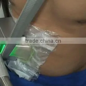 Antifreeze Membrane for Cryotherapy Slimming thumbnail-4