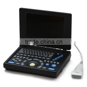 2016 China Medical Portable Mini Laptop Notebook B Mode B/W Ultrasound Machine Scanner With CE(PC Based) RUS-9000E2 thumbnail-3