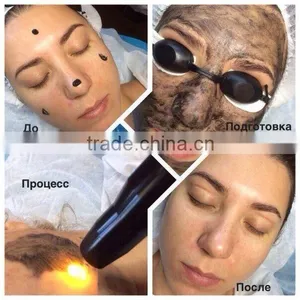 800mj Q-switch Tattoo Removal Nd Q Switch Laser Machine Yag Laser Long Pulse Nd:yag Equipment thumbnail-5