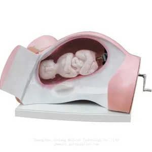 Model of Course of Delivery thumbnail-1