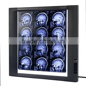 Ultra Thinner Medical Film Viewer Radiology Equipment thumbnail-1