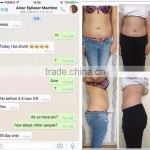Criolipolisis Lipo Cryo Fat Freeze Belt/cool Tech Fat Freezing Machine thumbnail-2