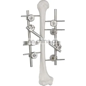 Guaranteed Quality Semi-circular External Fixator Orthopedic Surgical Implant thumbnail-5
