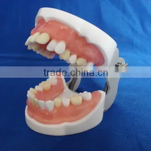 Typodent Dental Jaw Model for Practice Extract Tooth thumbnail-1