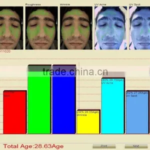 Computer Software Skin Analysis System Acne Wrinkle Spot Pore Analyzer Device thumbnail-6