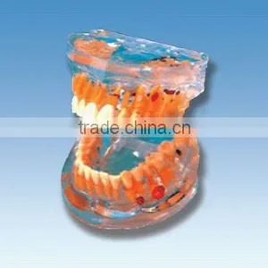 Pathology Transparent Teeth Model thumbnail-1