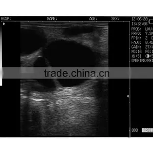Vet Ultrasound/Veterinary Products/ Diagnostic Equipment for Animal L60 thumbnail-4