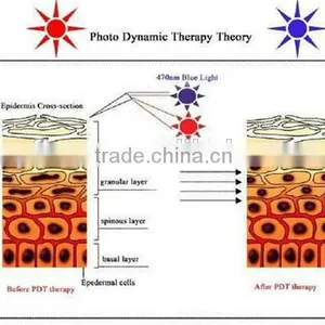 Wrinkle Removal Best Choice Face LED PDT Led Pdt Bio-light Anti-aging Therapy 7 Color Lights Pdt Machine In Usa Spot Removal thumbnail-2