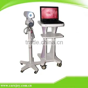 FY-9100A Excellent Portable Type Digital Electronic Colposcope thumbnail-1