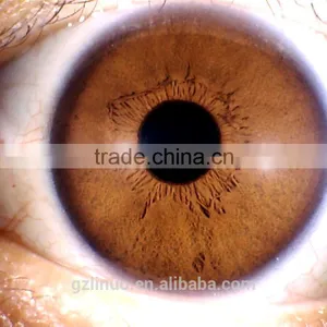 Wholesale Price 5MP Pixel Iridology Analyzer Camera thumbnail-5