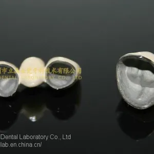 Dental Crown Porcelain Fused Metal, PFM, VMK, Dental Prostheses, Laboratoire Dentaire, Dentallabor, Laboratorio Dental, Dental Laboratory, Shenzhen LJ Dental Lab China thumbnail-4