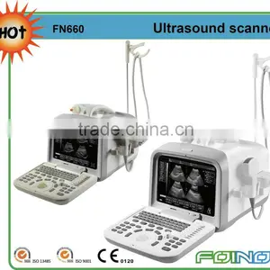 FN660 CE Approved Digital Ultrasonic Diagnostic Imaging System thumbnail-1