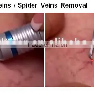 NEW 2016!!! 980nm Laser Spider Veins Removal Machine for Red Blood Silk Removal,angeioma Removal thumbnail-5