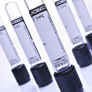ESR Tube Whole Blood Tubes Evacuated Blood Collection 3.2% or 3.8% Sodium Citriate(1:4)Tubes, Test Tube for Blood Sample Colletion (CE) thumbnail-1