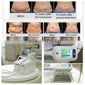 Whole Sale Freeze Sculptor Fat Freezing Cryolipolisis Slimming Fat Removal Weight Loss Machine thumbnail-6