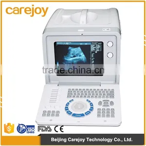 Healthcare Supplies Humanized Operating Design Portable Ultrasound Probe Diagnostic Ultrasound Scanner thumbnail-1