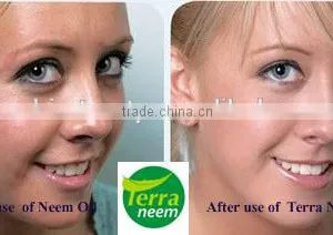 PURE NATURAL - Essential Neem Oil thumbnail-4