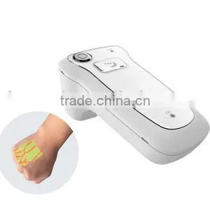 Konted Handheld Medical Infrared Vein Detector/Locator/Viewing thumbnail-1