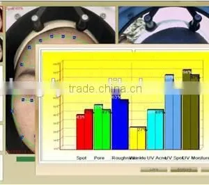 Professional Skin Analyzer / Amazing Magic Mirror for Skin Test thumbnail-4
