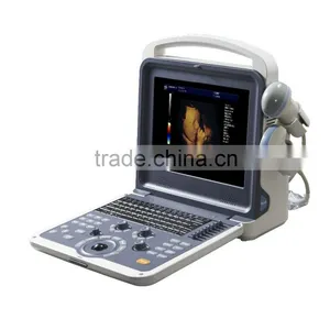 Digital Color Doppler 4D Ultrasound Machine K6 thumbnail-4
