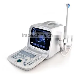Portable PC Platform 3D Ultrasound Scanner Diagnosis of Abdomen Cardiac Gynecology Obstetrics Thyroid Gland Small Organs Urology thumbnail-2