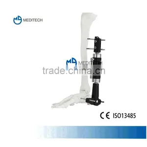 Orthofix External Fixation Orthopedic Instruments Ankle Joint Type thumbnail-1