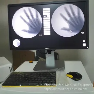 RX2310C High Frequency Mobile Digital C-arm System thumbnail-3