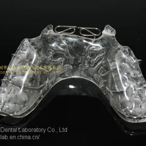 Space Expanders, Nance Appliance, Helix Appliance, Pendulum Appliance, ﻿﻿﻿﻿Porter Appliance, Fixed Lingual Expander, Sagittal Screw Appliance, Hyrax Rapid Palatal Expander, Orthodontic Retainers, Dental Orthodontic Appliance, Laboratoire Dentaire, Dentall thumbnail-5