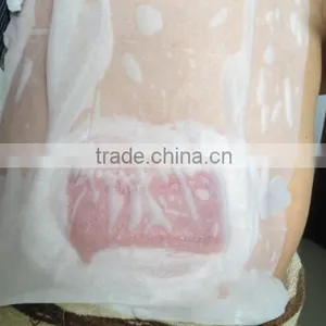 Antifreeze Membrane for Cold Lipolysis thumbnail-5