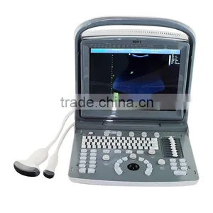 2015 Hot Selling Veterinary Instrument Ultrasound Scanner ECO1 VET With 2.5-11MHz Probe Frequency thumbnail-3