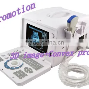Multi Probe Optional Ultrasound Scanner RUS 6000D With CE Certification thumbnail-1