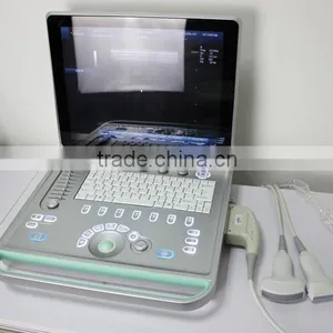 3D 4D Portable Color Doppler Ultrasound Machine C5 thumbnail-3