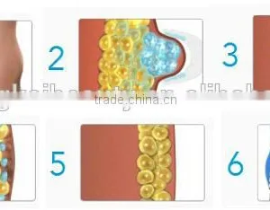 Most Popular Products Lipo Cryo Slimming Machine thumbnail-4