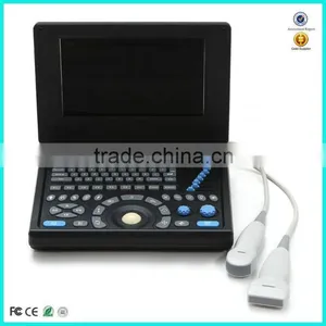 Hot Sale China Factory Medical Two Probe/transducer Connectors Portable Ultrasound Machine for Pregnancy thumbnail-1