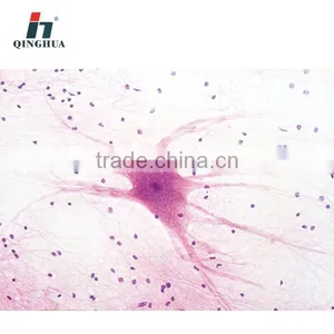 Slide 4261 Motor Neuron.w.m. thumbnail-1