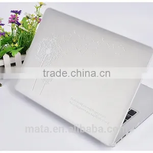 Cartoon Snoopy Case For Macbook Pro, PC Case For Macbook Air 13 Inch thumbnail-2