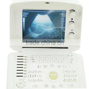 Good Price 10 Inch Digital Ultrasound Machine With Convex Probe for Hospital Clinic Community With CE Certification thumbnail-4