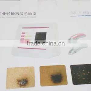 Skin Scanner uv Analysis Machine Factory China POP IPL thumbnail-3