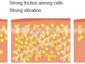 5 in 1 Ultrasonic Cavitation Machine Shockwave Therapy Machine thumbnail-5
