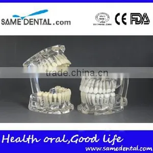 Dental Standard Transparent Dentition Model DEA-46 thumbnail-1