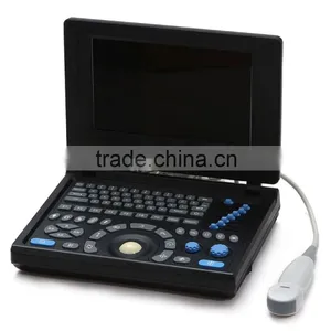 2016 CE&ISO Best Price of Portable/Notebook/Laptop Ultrasound Scanner/machine With Convex, Linear, Vaginal, Rectal Transducer thumbnail-2