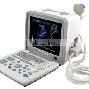 Ultrasound Machine Scanner With Convex Probe Transvaginal Micro-convex Rectal Probe With CE ISO Approved thumbnail-2