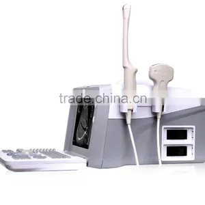Portable Ultrasound Scanner Price, Hospital Full-digital Laptop 2018CI thumbnail-2