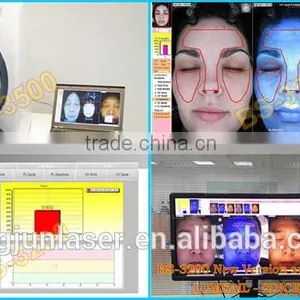 2016 Latest Amazing Magic Skin Analyzer, Skin Scope Analyzer thumbnail-3