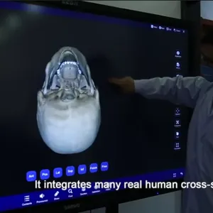 86 Inch Medical Teaching Machine 3D Virtual Anatomy Table Human Database Multi-functional Medical Education System thumbnail-3