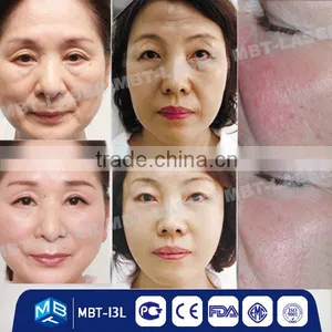 Professional RF Wrinkle Removal Beauty Machine of Radio Frequency Machine for Salon Use thumbnail-4