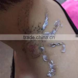 Naevus Of Ota Removal Q Switch Nd Yag Laser Mongolian Spots Removal Tattoo Removal Machine For Permanent Makeup 1 HZ thumbnail-3