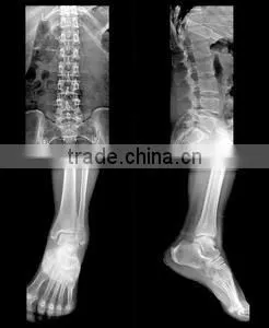 Konida Automatic Medical X-ray Film Agfa Fuji Dry Film thumbnail-3